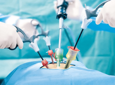 Laparoscopic Surgery in Indore, Laparoscopic Surgeons in Indore , arpit hospital